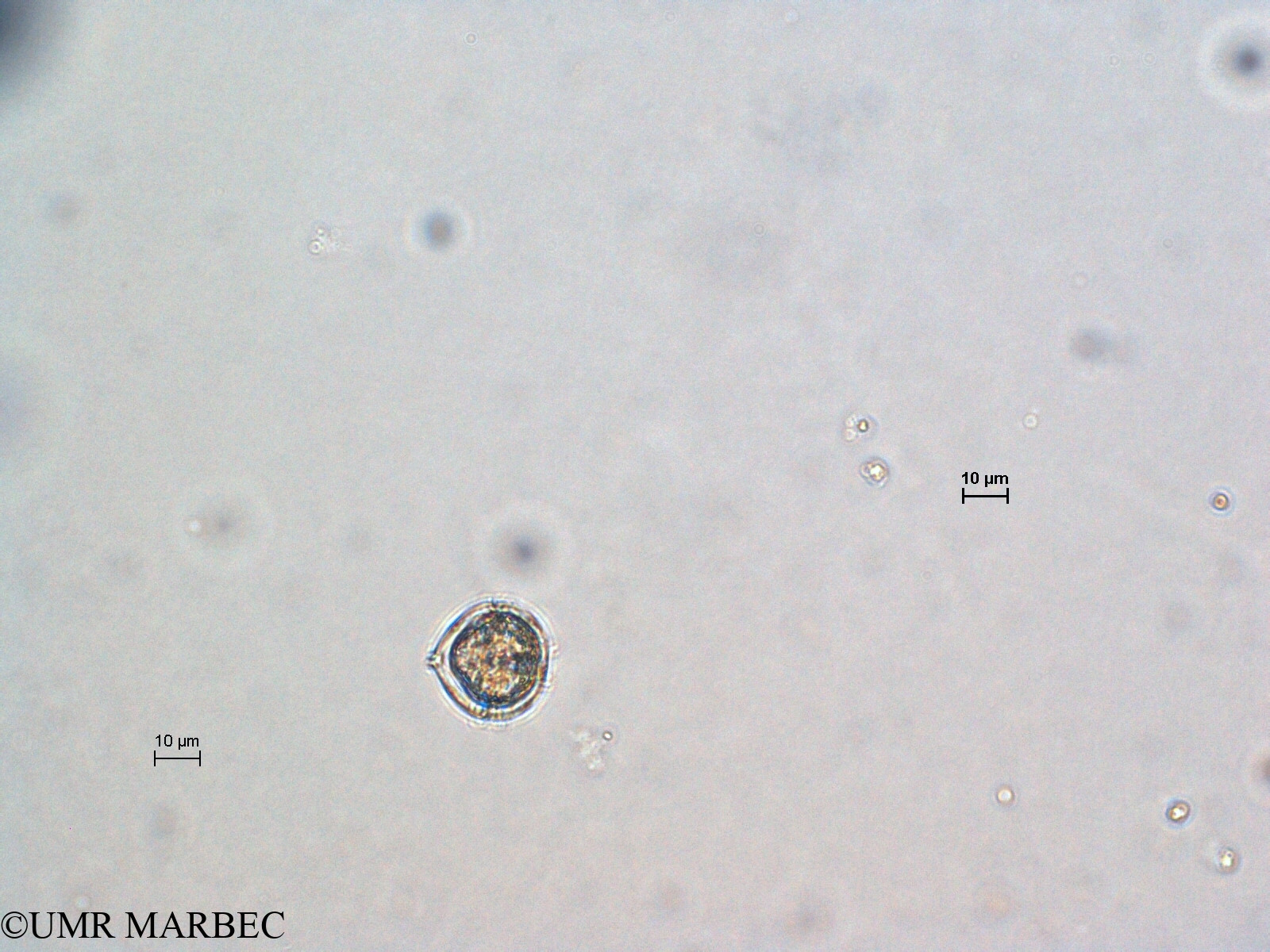 phyto/Scattered_Islands/all/COMMA April 2011/Protoperidinium sp7 (recomposé -2)(copy).jpg